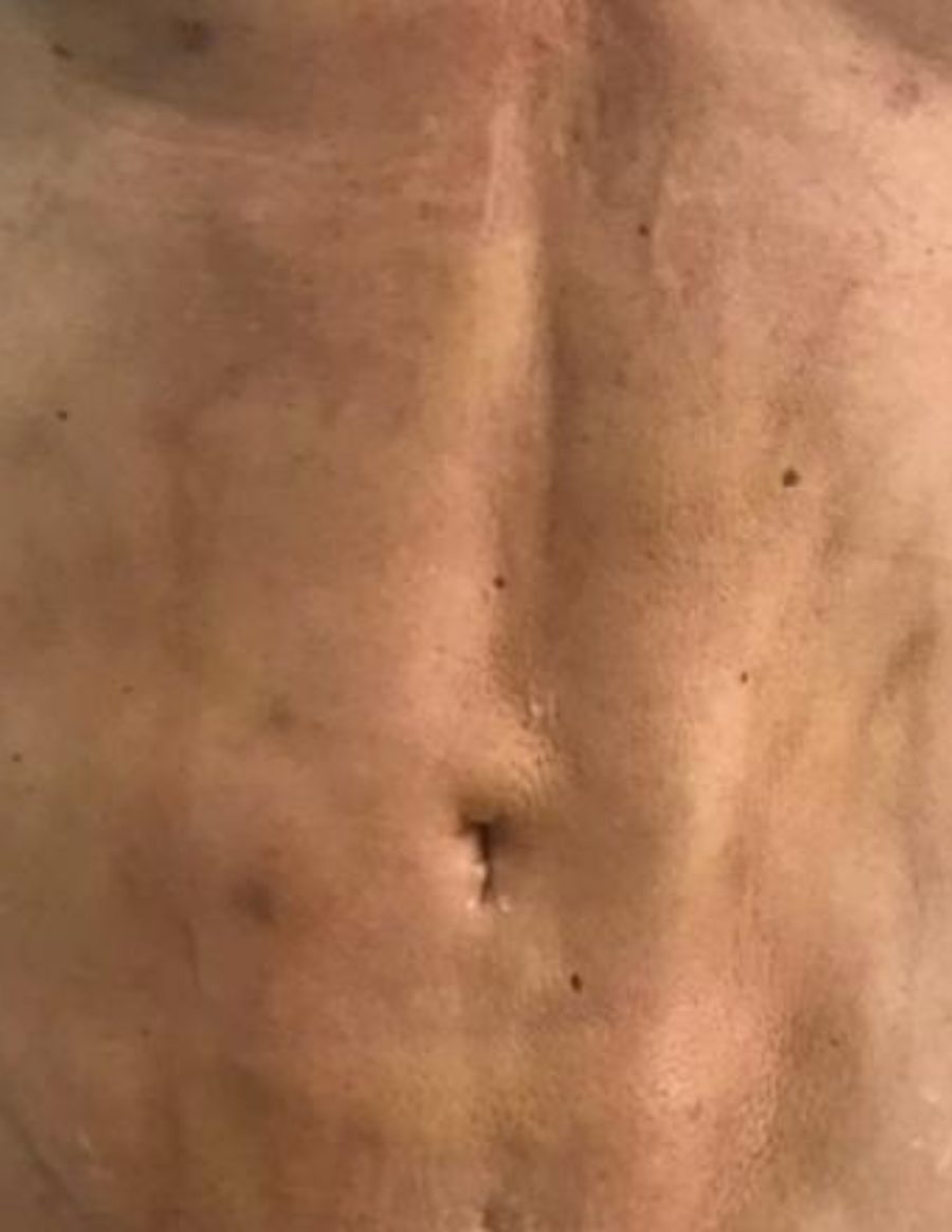 Recuperación estética